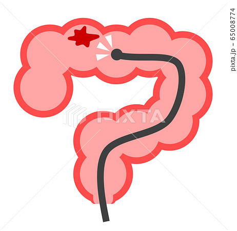 大腸カメラのイラスト素材