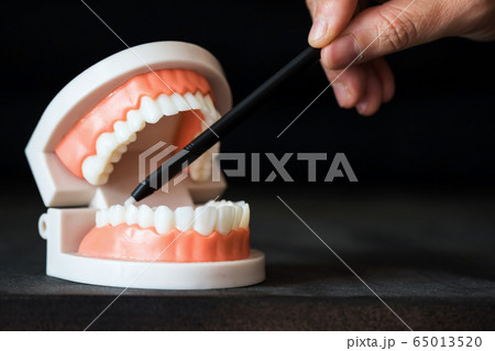 Dentist point pen to lower molar tooth 65013520