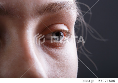 Shot of young woman's face without make-up 65071806