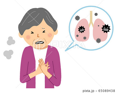 肺炎　高齢者　シニア女性 65089438