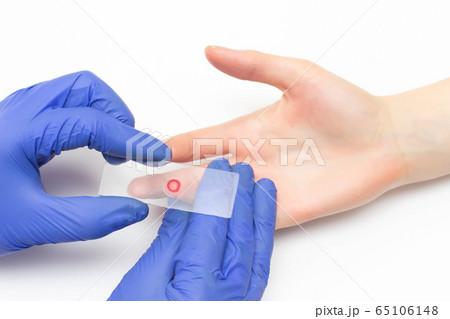 The doctor takes blood from his finger General clinical analysis for the study of the blood of the immune system and plasma, close-up, immunoglobulin 65106148