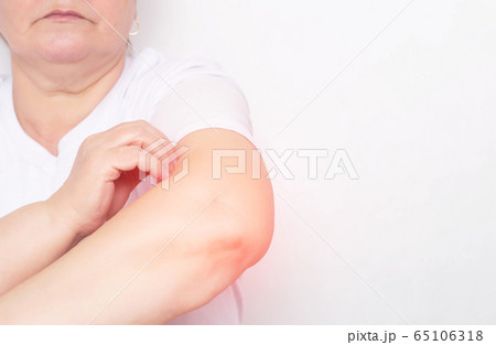 Woman holding her elbow joint, inflammation and pain in the elbow joint, tendens and bursitis, white background, copy space 65106318