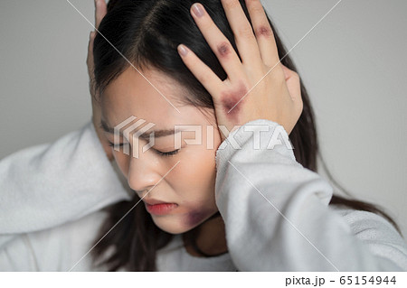 身体に傷のある若い女性 65154944