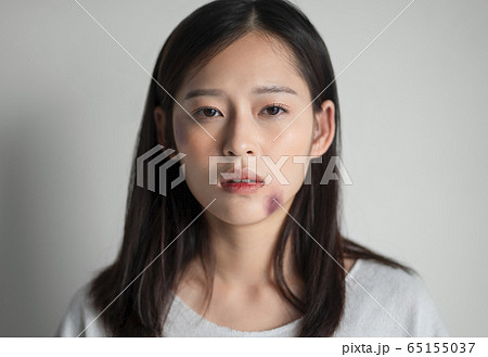 身体に傷のある若い女性 65155037