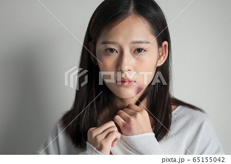 身体に傷のある若い女性 身体に傷のある若い女性 65155042