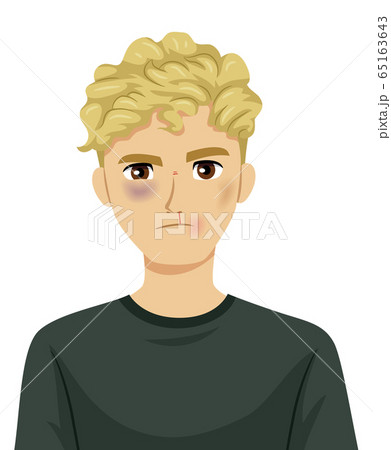 Teen Boy Fight Bruises Illustration 65163643