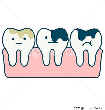 むし歯のイラスト素材 むし歯のイラスト素材