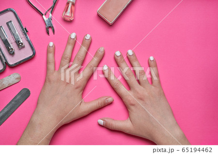 Overgrown nails with an old cracked gel polish. Self-removal of old gel polish from nails with a nail file. Overgrown nails with an old cracked gel polish. Self-removal of old gel polish from nails with a nail file. 65194462