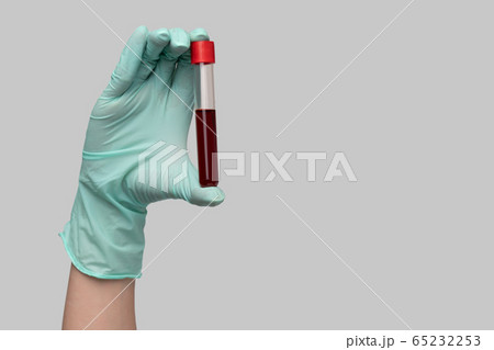 hand holding blood in test tube close up over light gray background hand holding blood in test tube close up over light gray background 65232253