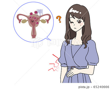 子宮筋腫に苦しむ女性 子宮筋腫に苦しむ女性 65240666