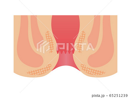 肛門 直腸の構造断面図イラスト 人体 医療 文字なしのイラスト素材