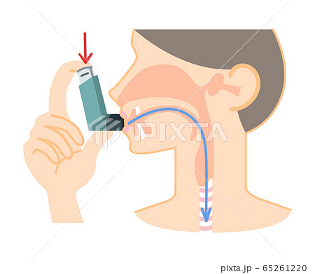 喘息の吸入薬を吸い込む人のイラスト サルタノール 図表 矢印あり のイラスト素材