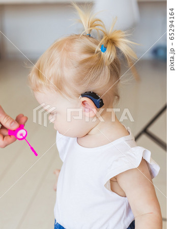 Baby girl wearing a hearing aid. Disabled child, disability and deafness concept. 65294164