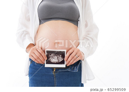 エコー画像を持つ若い妊婦 エコー画像を持つ若い妊婦 65299509