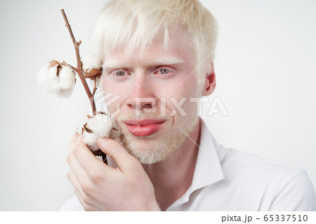 portrait of an albino man in studio dressed portrait of an albino man in studio dressed 65337510
