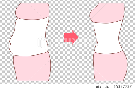 女の子　ダイエット　ビフォーアフター 65337737