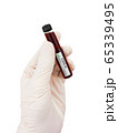 Coronavirus Covid 19 blood sample in sample tube 65339495
