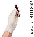 Coronavirus Covid 19 blood sample in sample tube 65339497