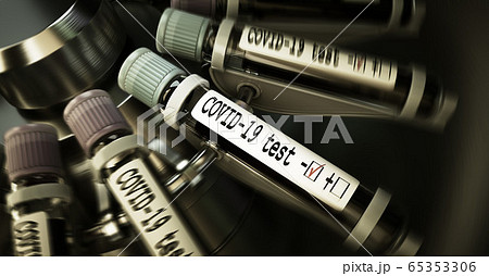 Vials of blood in a centrifuge. Negative COVID-19 test and laboratory sample of blood testing for diagnosis new Corona virus infection novel corona virus disease 2019 from Wuhan. Pandemic infectious 65353306