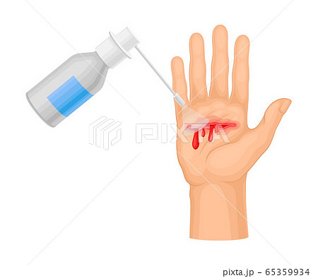 Hand with Wound Streaming Blood Cleaning with Pharmaceutical Substance Procedure Vector Illustration 65359934