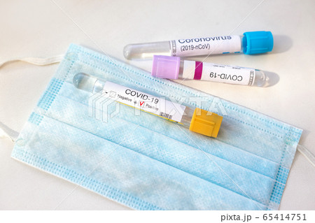Coronavirus 2019-nCoV Blood Samples Medical Concept. Covid-19 Coronavirus 2019-nCoV Blood Samples Medical Concept. Covid-19 65414751
