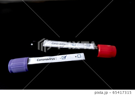 Professional doctors perform COVID-19 tests from samples of blood tests to diagnose coronary virus infections analysis and sampling of infectious diseases medical concepts and health care 65417315