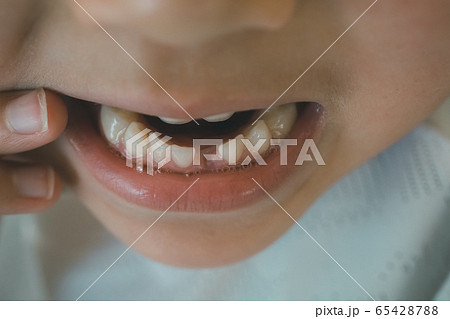 6 years old 6 years old 65428788