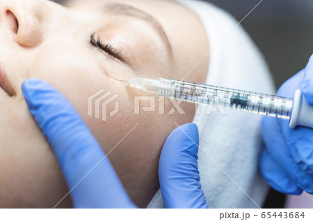 Young Caucasian patient getting an anti-wrinkle injection 65443684
