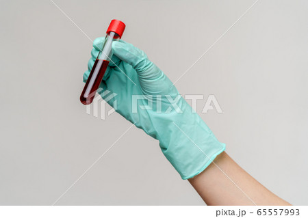 hand in latex glove holding blood in test tube close up hand in latex glove holding blood in test tube close up 65557993