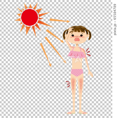 Children swimwear sunburn 02 sun 65584789