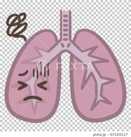 Lung disease 65589327