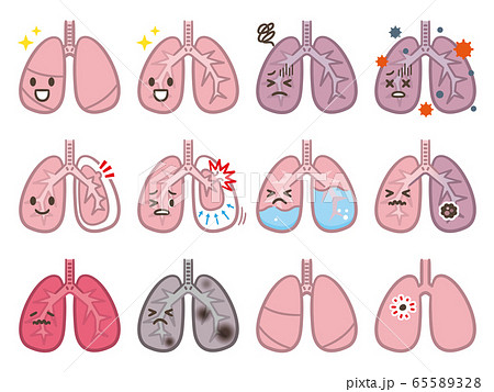 肺 病気 セットのイラスト素材