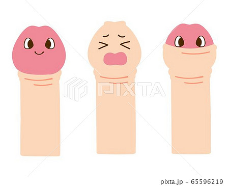 男性悩み　包茎のイラスト 65596219