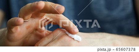 Male hard hands with calluses apply moisturizer 65607378