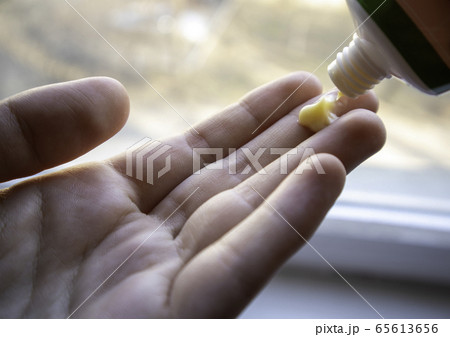 The cream is squeezed out of the tube. Cream on the hand. 65613656