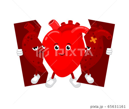 Healthy heart character holding tear of unhealthy heart. Healthy heart character holding tear of unhealthy heart. 65631161