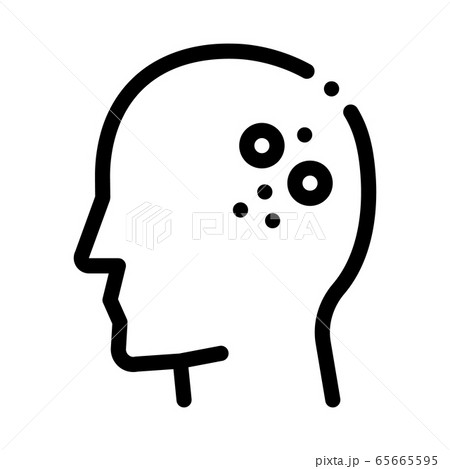 main problem of dermatitis icon vector outline illustration 65665595