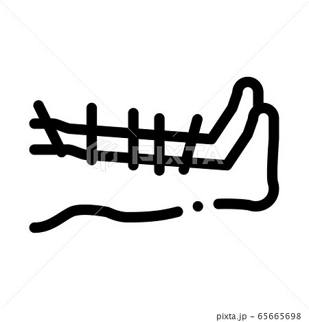 acupuncture feet icon vector outline illustration acupuncture feet icon vector outline illustration 65665698