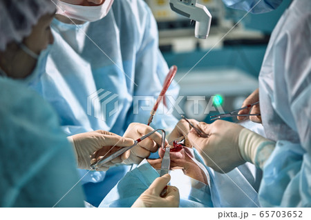 A surgeon with gloves is operating on his nose. Rhinoplasty, close-up operation. Blue light, teamwork, health, beauty. A surgeon with gloves is operating on his nose. Rhinoplasty, close-up operation. Blue light, teamwork, health, beauty. 65703652