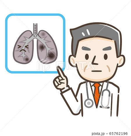 肺癌 医師のイラスト素材