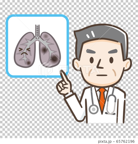 肺癌醫生 65762196