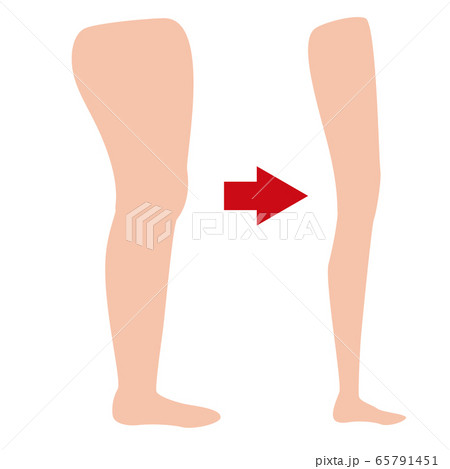 ダイエット 脚やせ 素足 ダイエット 脚やせ 素足 65791451