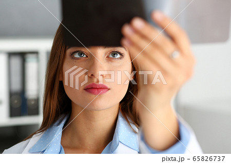 Beautiful female doctor hold in arm xray picture Beautiful female doctor hold in arm xray picture 65826737