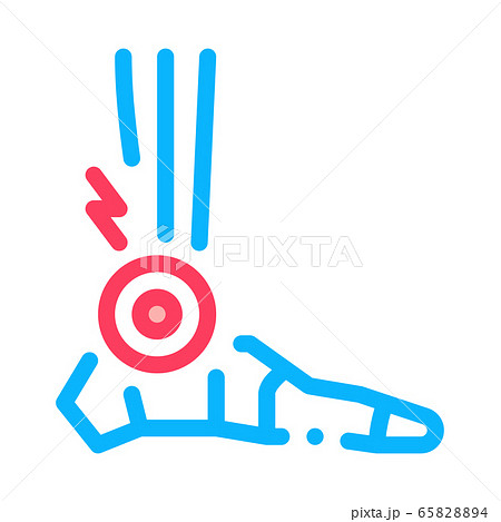 rheumatoid arthritis of foot icon vector outline illustration 65828894