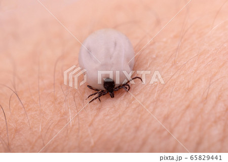 Tick (Ixodes ricinus) isolated on white Tick (Ixodes ricinus) isolated on white 65829441