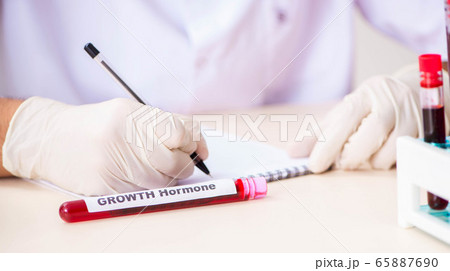 Young handsome lab assistant testing blood samples in hospital 65887690
