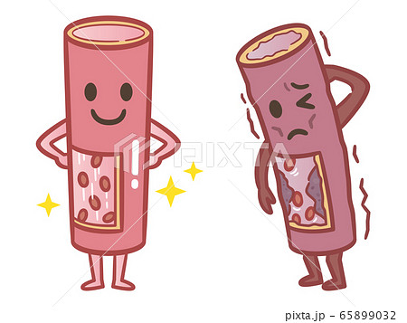 血管 血管 65899032