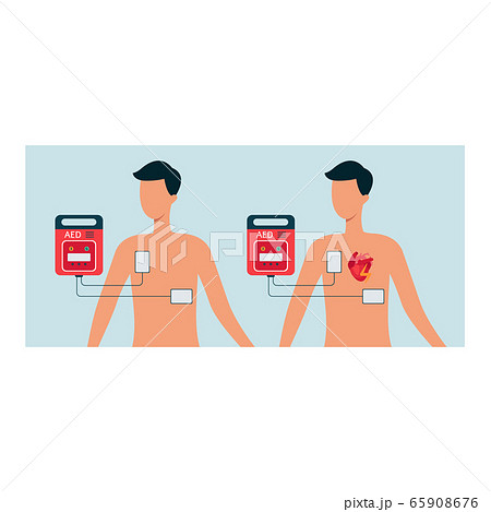 Automated external defibrillator with human and man body, aed concept for heart. 65908676