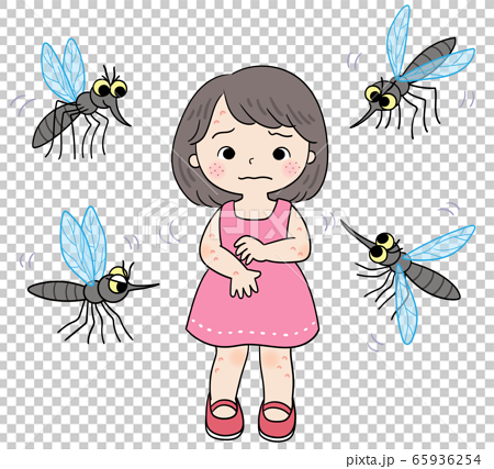 Female mosquito bites, swelling of the skin,... - Stock Illustration  [65936254] - PIXTA