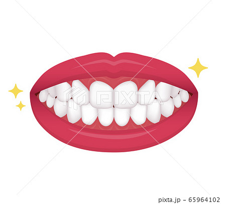 歯列矯正 歯の矯正 ベクターイラスト 整った歯並びのイラスト素材